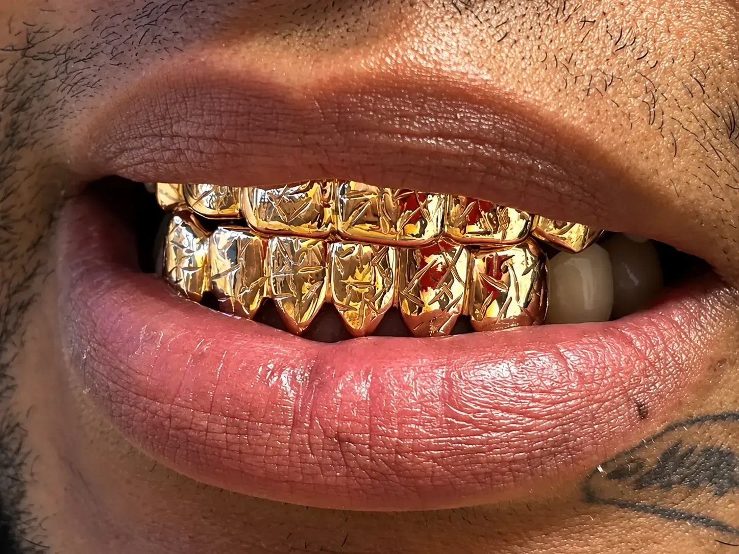 gold grill top and bottom