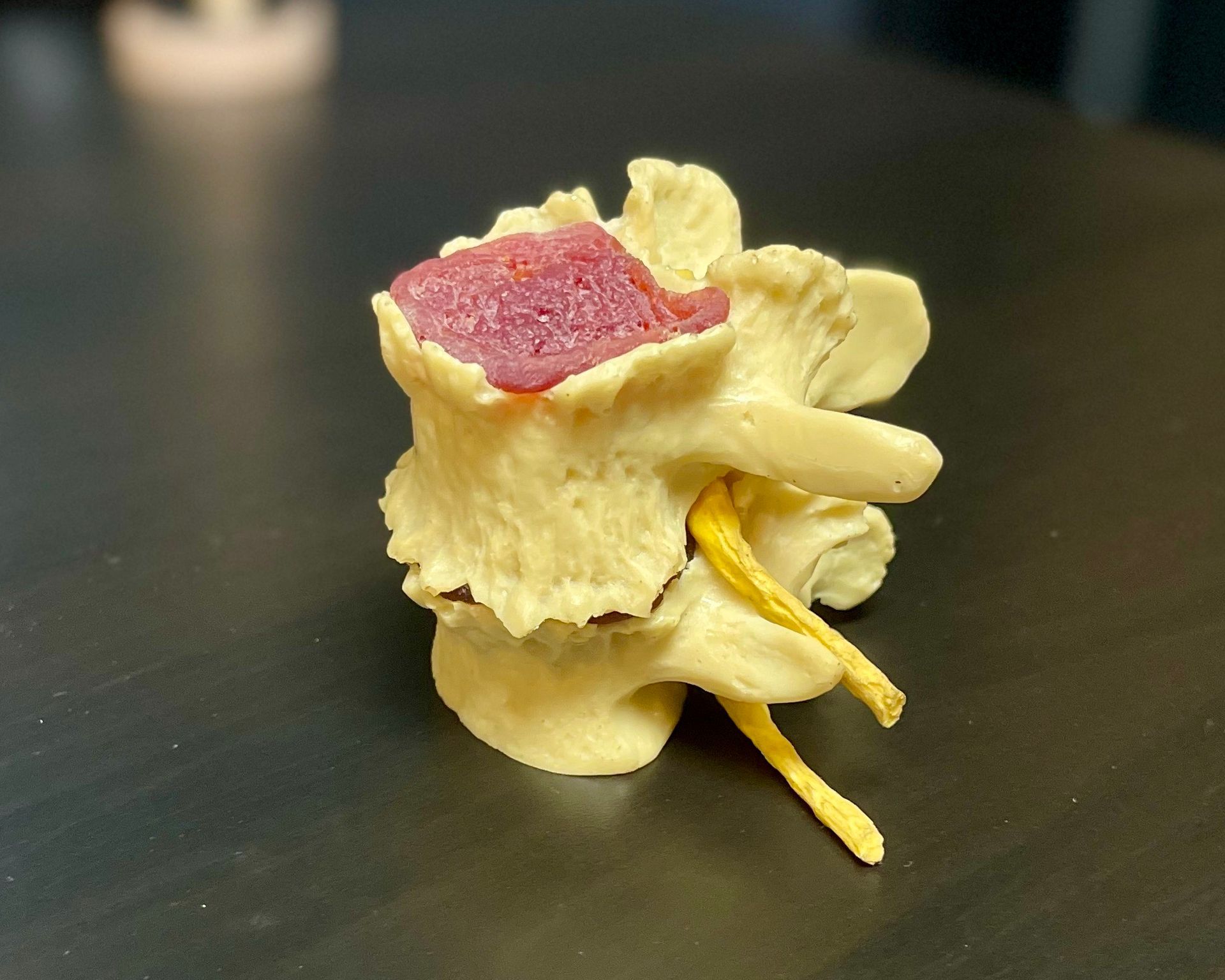 Physio Vs. Osteo