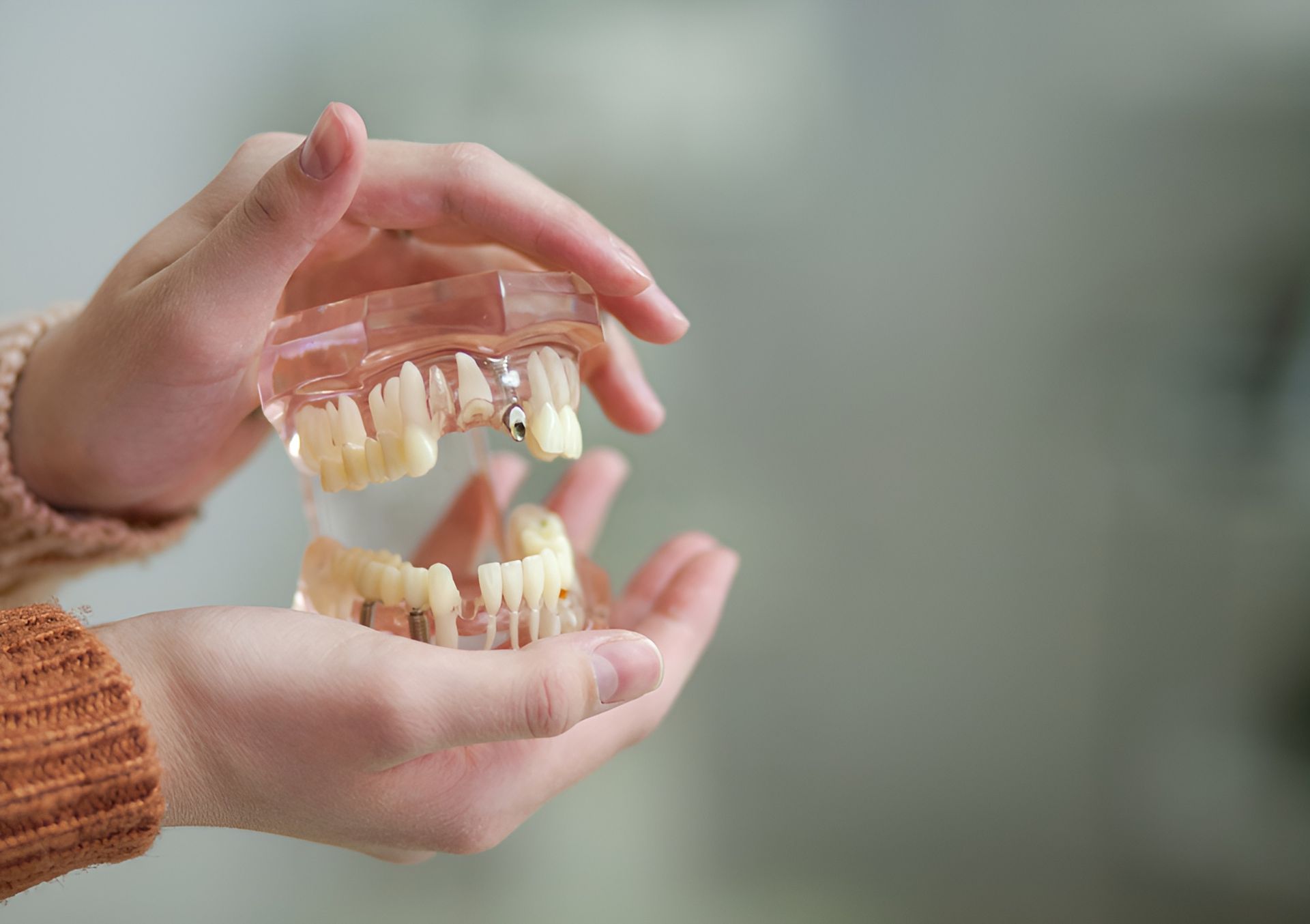 A Person Is Holding a Model of Teeth in Their Hands — Steve King Dental Group in Mossman, QLD