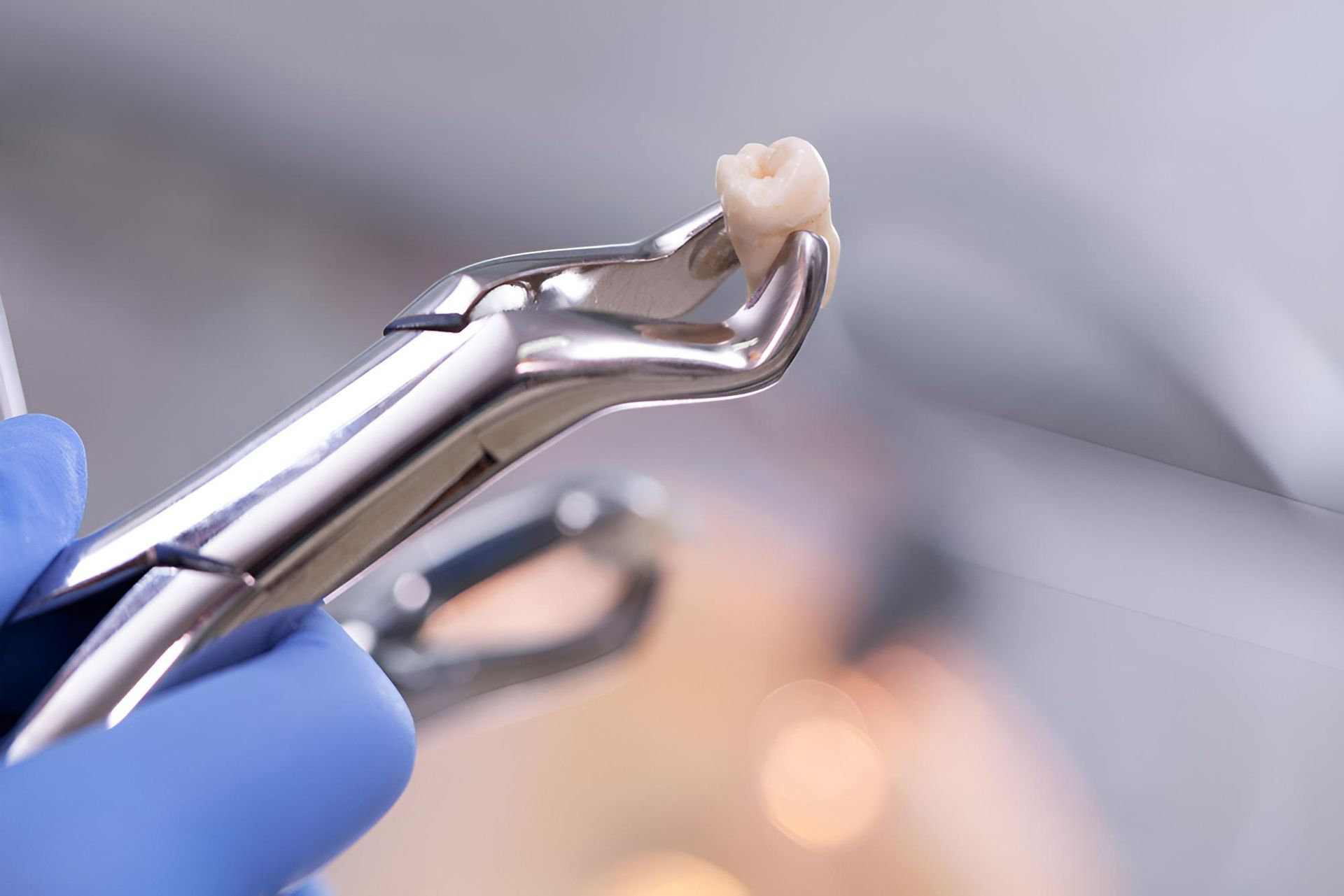A Dentist Is Holding a Pair of Pliers with A Tooth in It — Steve King Dental Group in Manunda, QLD