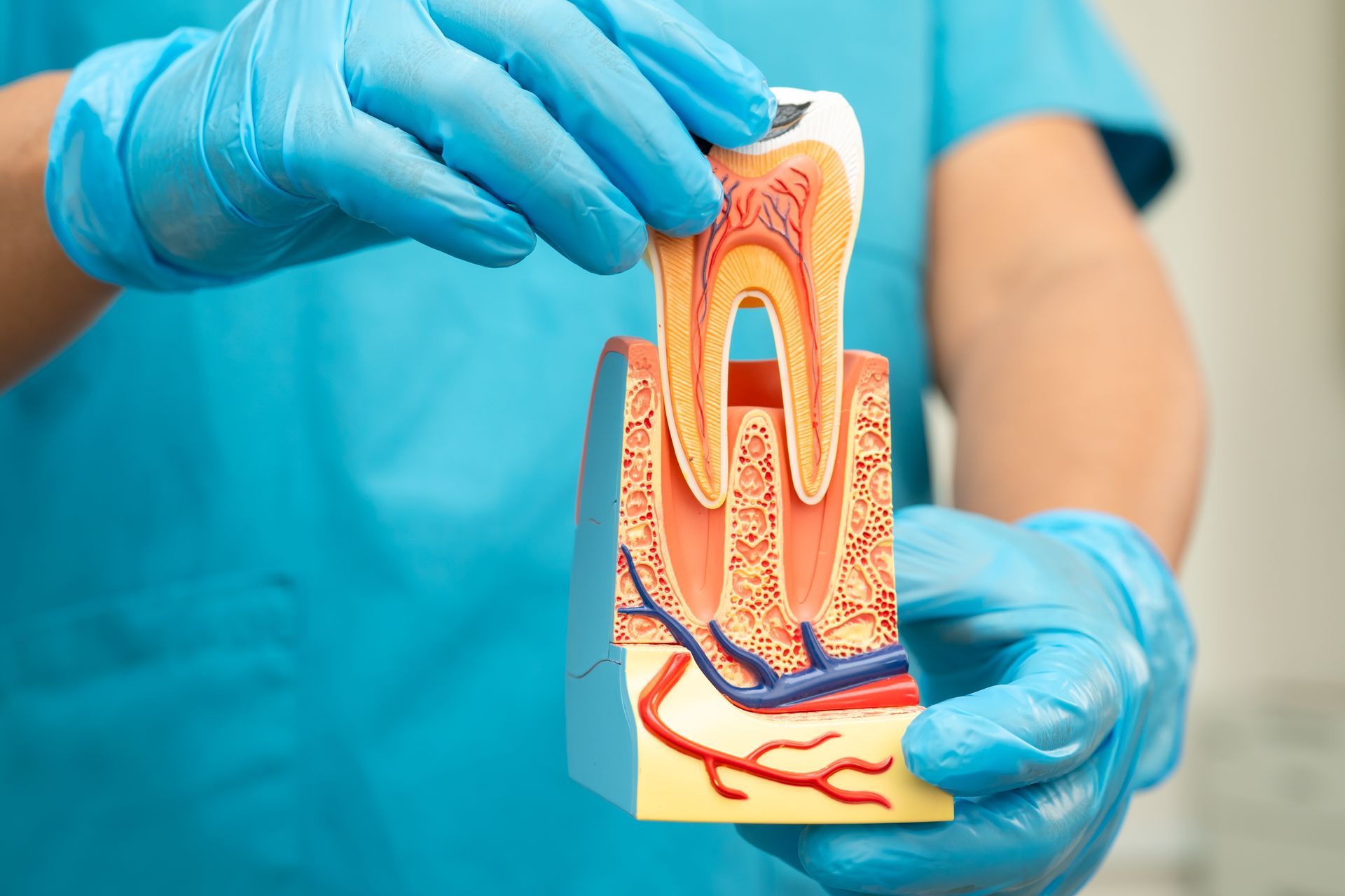 Gloved hands holding a color dental tooth model with cross-section details