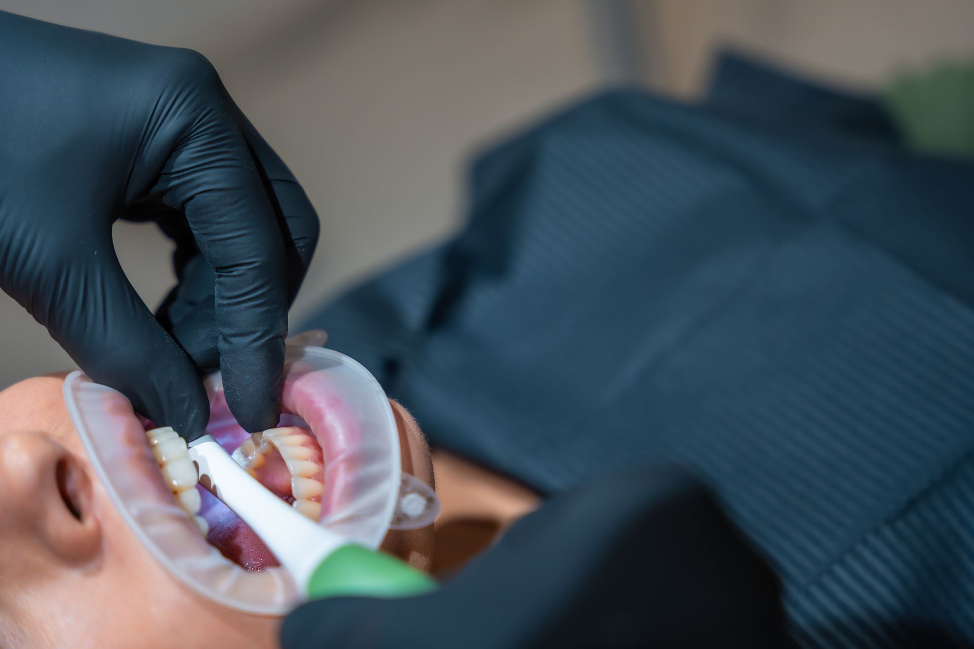 Dentist cleaning a patient’s teeth with a dental tool and mirror while wearing gloves