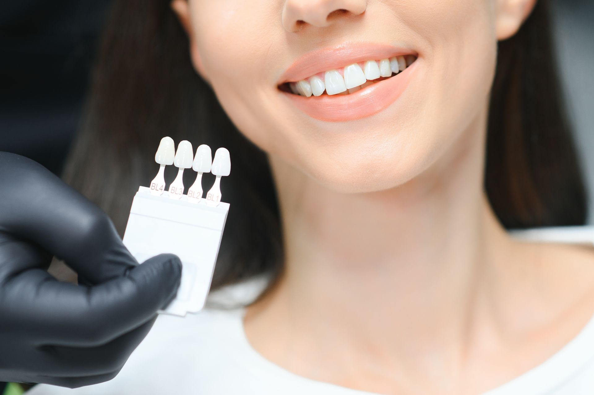 Dentist holding a shade guide near a smiling patient’s mouth
