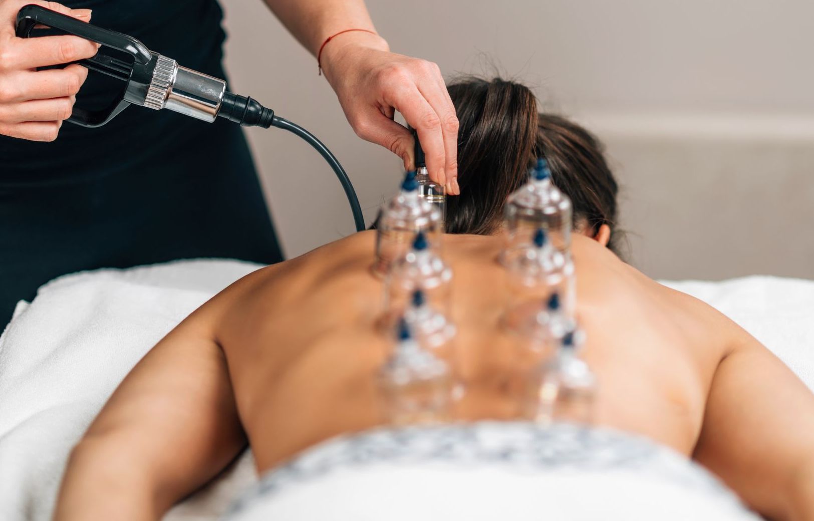 A woman is getting a cupping treatment on her back.