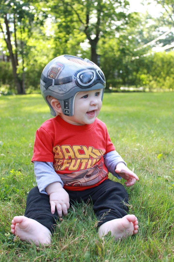CRANIAL REMOLDING HELMETS