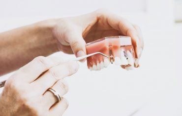 A person is holding a model of a tooth with a fork.