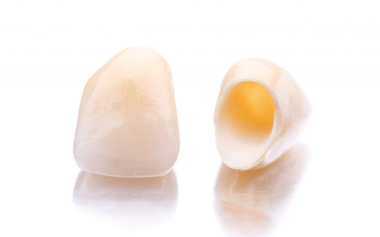 Dental Crowns Dental Crowns