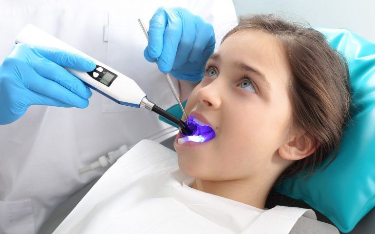 Dental Sealants Dental Sealants