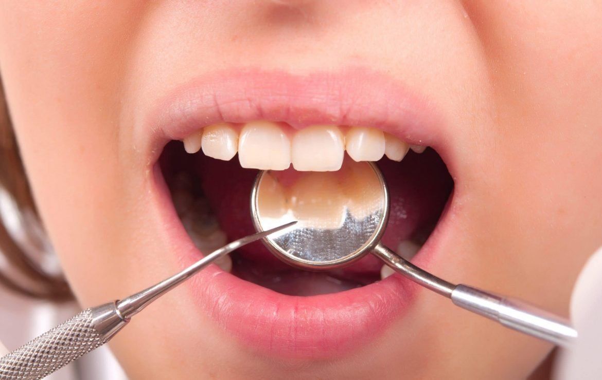 A woman is getting her teeth examined by a dentist.