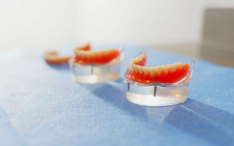 Extractions Extractions