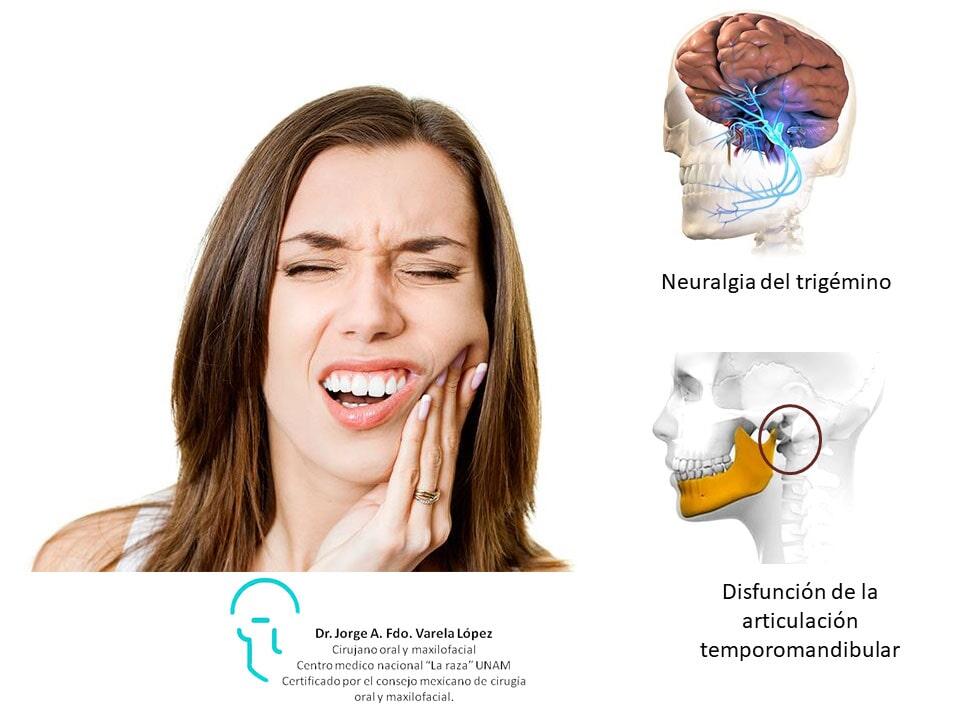 JORGE ALBERTO FERNANDO VARELA LÓPEZ-dolor facial