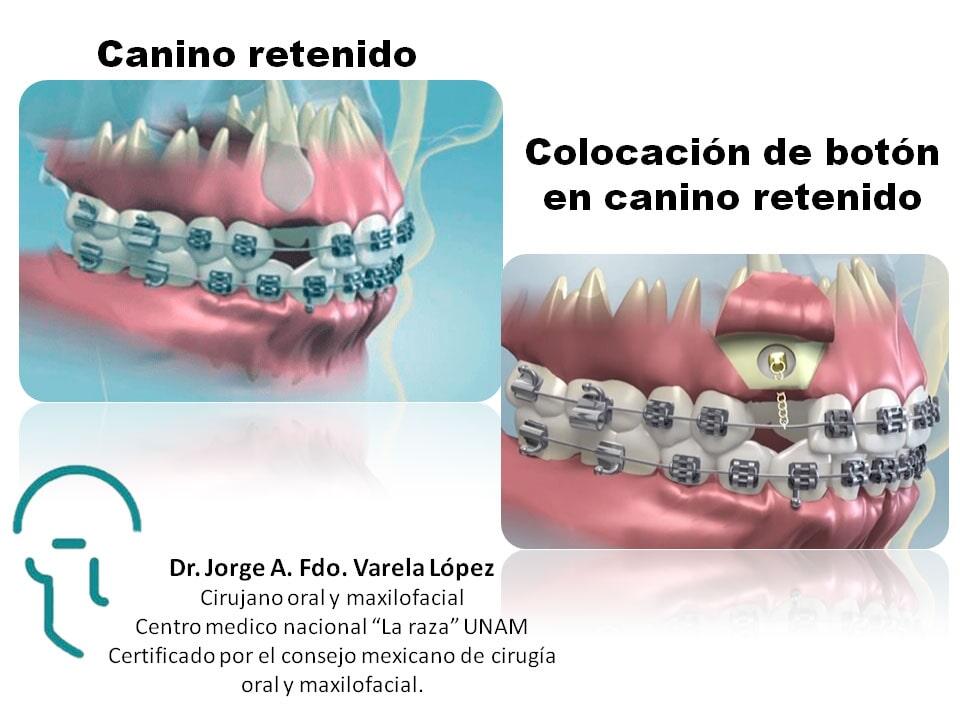 JORGE ALBERTO FERNANDO VARELA LÓPEZ-canino retenido