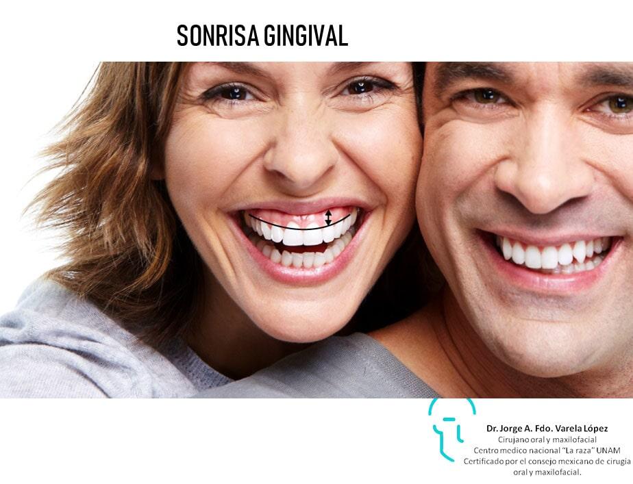 JORGE ALBERTO FERNANDO VARELA LÓPEZ-Sonrisa gingival
