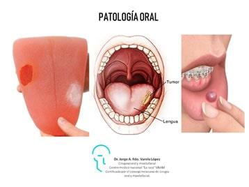 JORGE ALBERTO FERNANDO VARELA LÓPEZ-patología oral