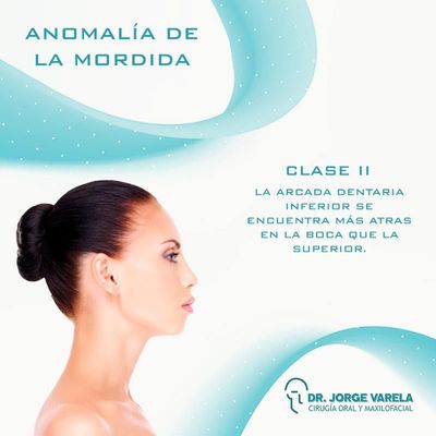 Anomalía de la Mordida