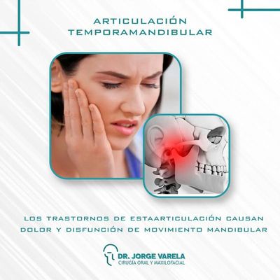 Articulación Temporomandibular