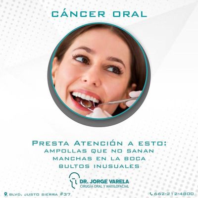 Cáncer Oral