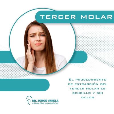 Cirugía del Tercer Molar