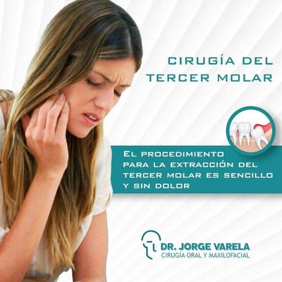 Cirugía para extracción de Muelas