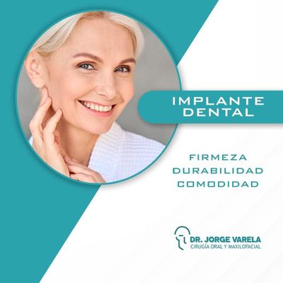 Implantes Dentales