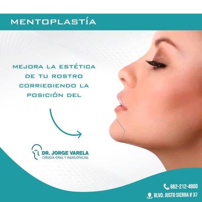 Mentoplastia o Cirugía de Mentón