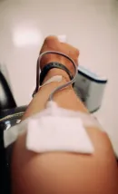 Laser hair removal treatment on an arm, with a clinician holding a handheld device in a clinic