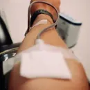 Laser hair removal treatment on an arm, with a clinician holding a handheld device in a clinic