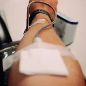 Laser hair removal treatment on an arm, with a clinician holding a handheld device in a clinic