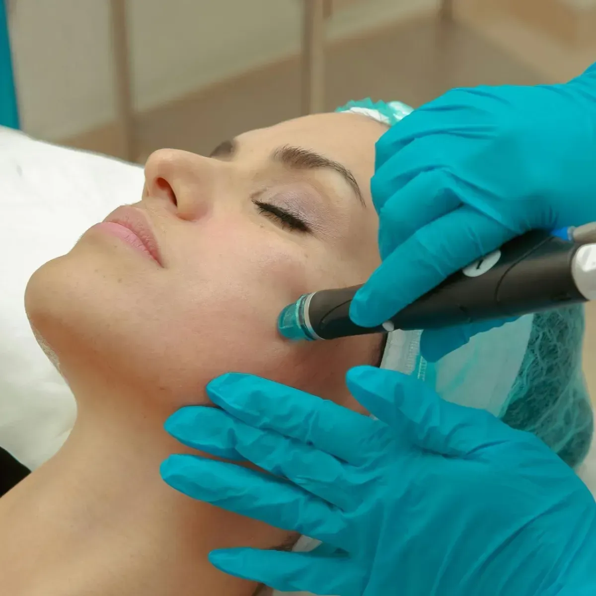 Gloved clinician applying facial treatment with a handheld device to a woman lying back on a treatment bed
