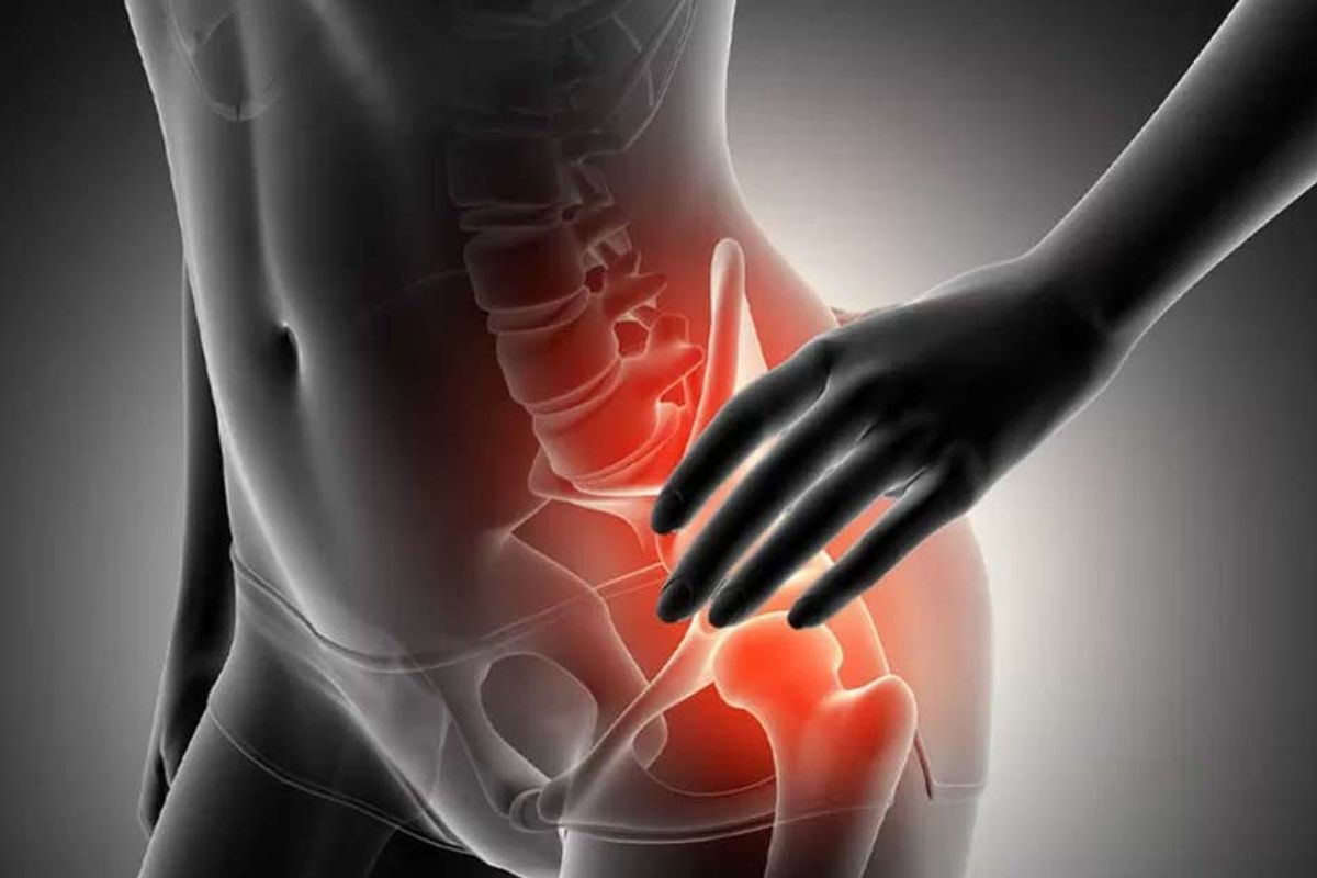 Do diagnóstico à recuperação da bursite no quadril: guia completo