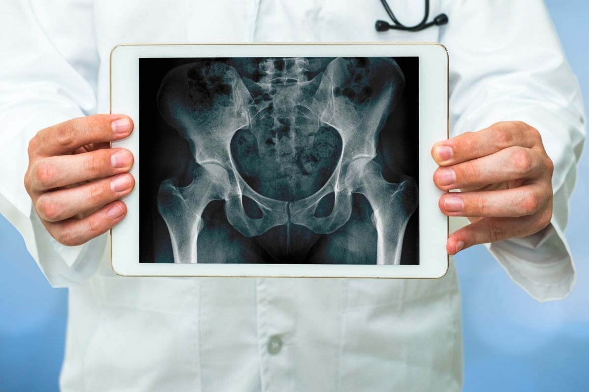 dr-ricardo-kirihara-ortopedista-infiltracao-quadril-efeitos-colaterais