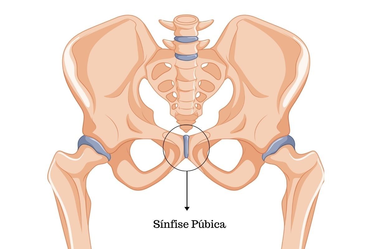 osteite-pubica-o-que-e-dr-ricardo-kirihara-ortopedista-quadril-sao-paulo