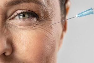 DRA. LAURA ELENA GARCÍA ORTEGA- BÓTOX FILLERS