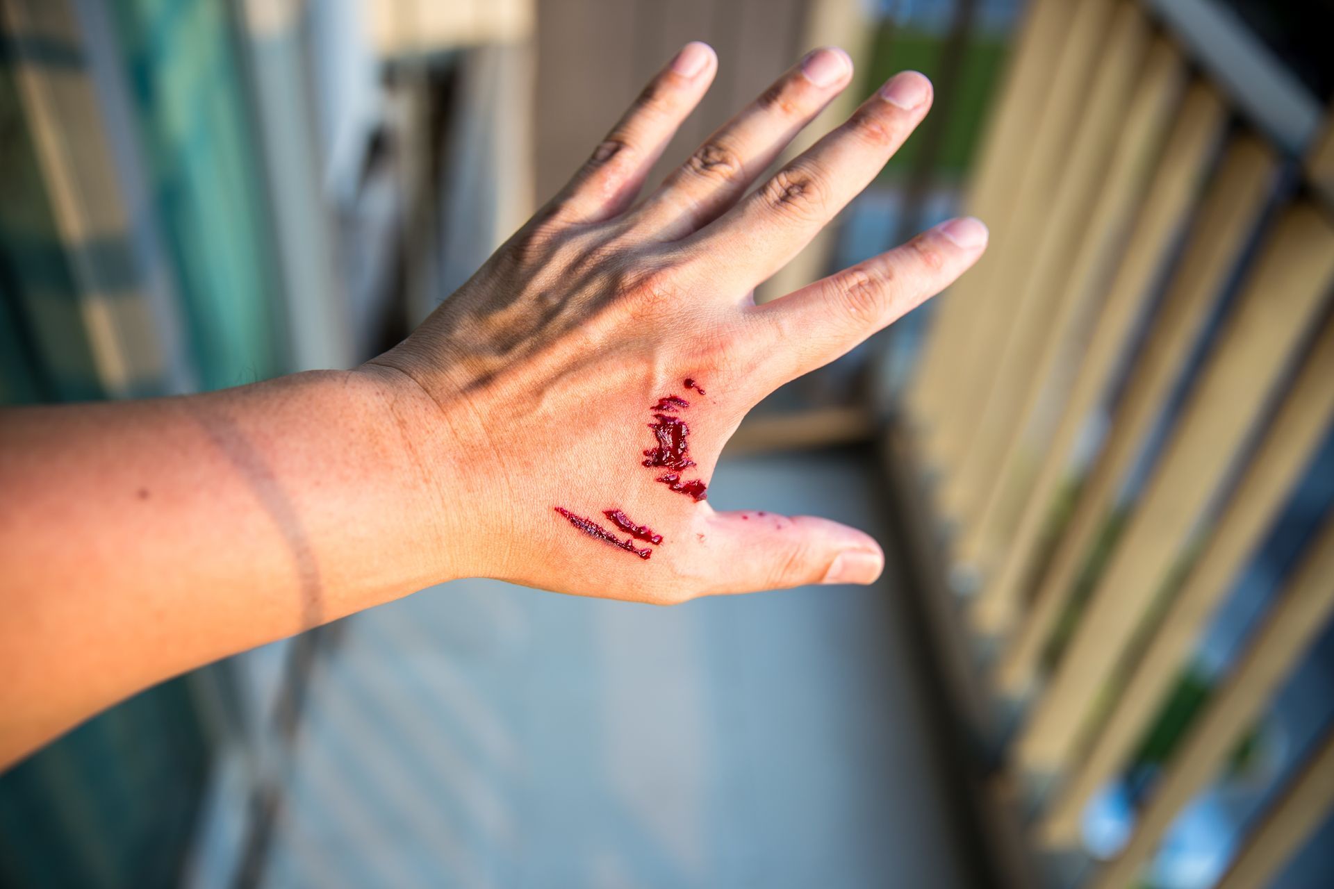 Injured hand with blood on the back, held up against a blurred railing background Injured hand with blood on the back, held up against a blurred railing background