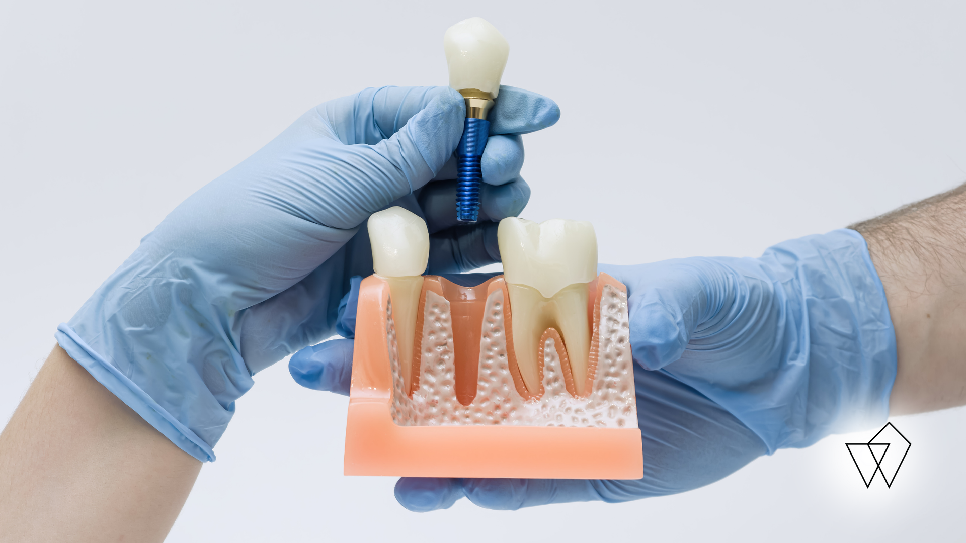Gloved hands placing a dental implant into a model of teeth and gums