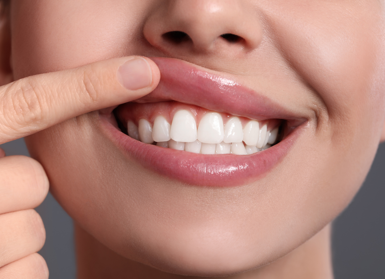 Close-up of a person's mouth, smiling with bright white teeth and a finger pulling up the lip.