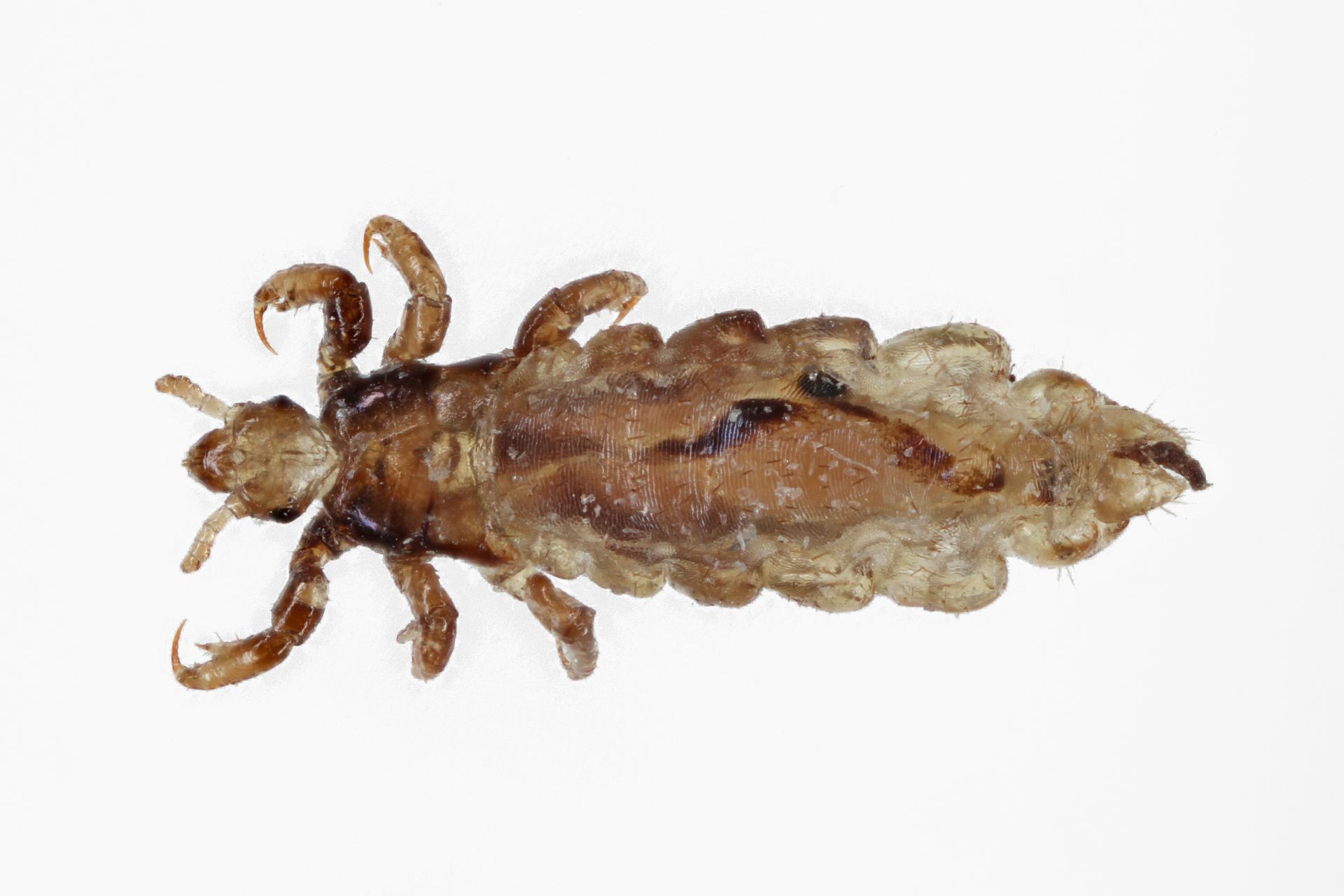 human biting lice or nits
