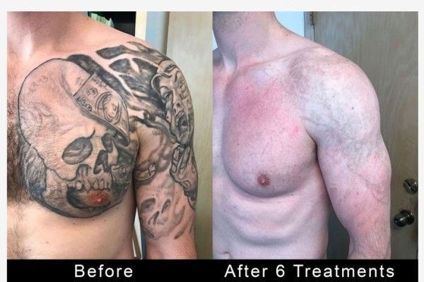 A before and after photo of a man 's chest and arms