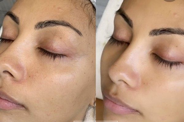 A before and after photo of a woman 's face with her eyes closed.