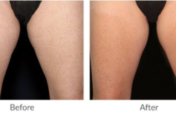 A before and after photo of a person 's legs