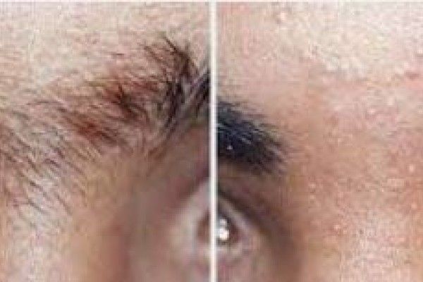 A before and after picture of a man 's eyebrows.
