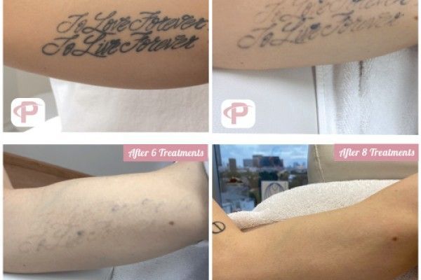 A before and after photo of a tattoo on a woman 's arm