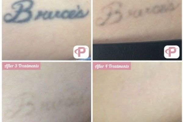 A before and after photo of a tattoo that says bruce 's