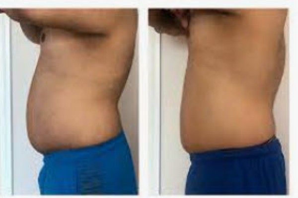 A before and after picture of a man 's stomach.