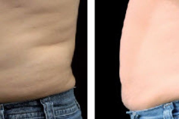 A before and after picture of a man 's stomach in jeans.