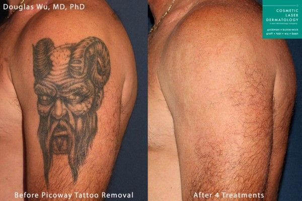 A before and after picture of a tattoo on a man 's arm