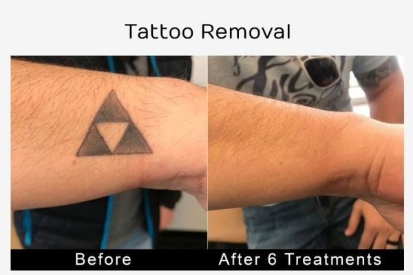 A before and after photo of a tattoo on a man 's arm