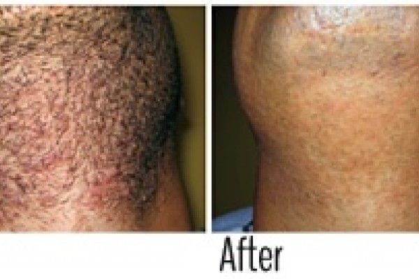 A before and after photo of a man 's hair.