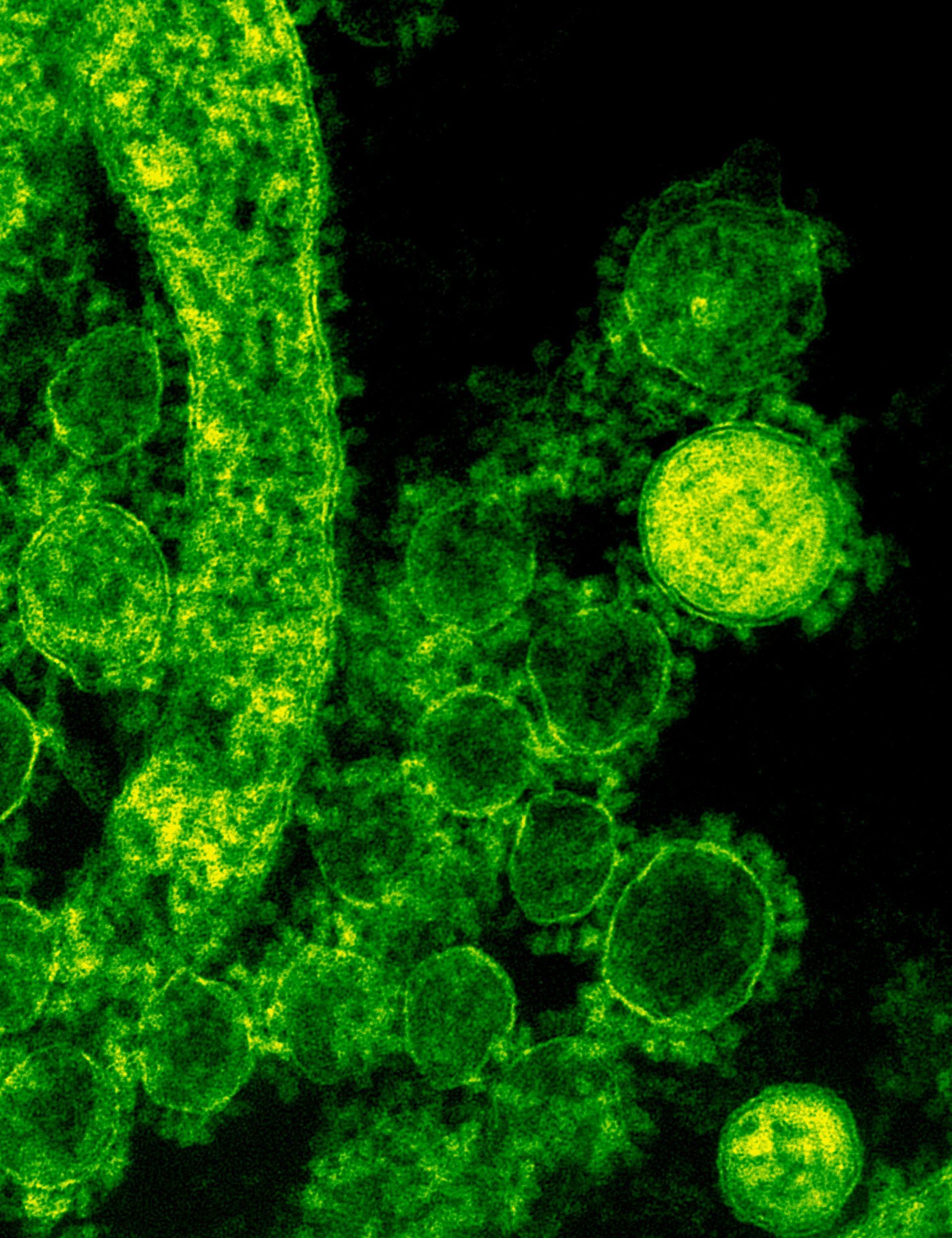 Green-toned electron microscopic image of spherical viral particles budding from a membrane.