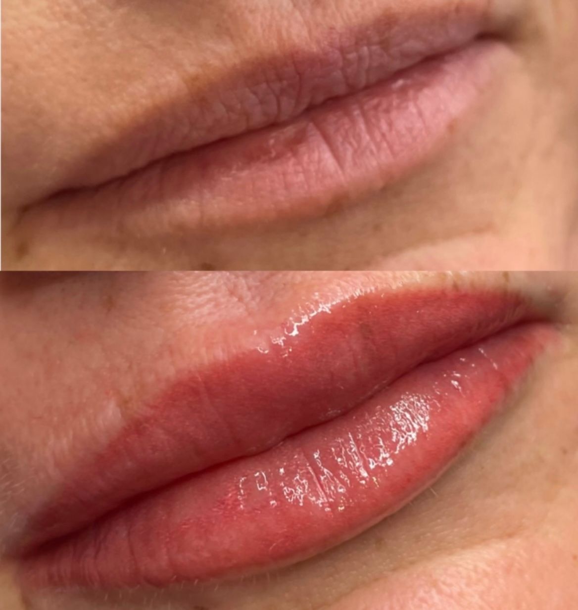 lip blush